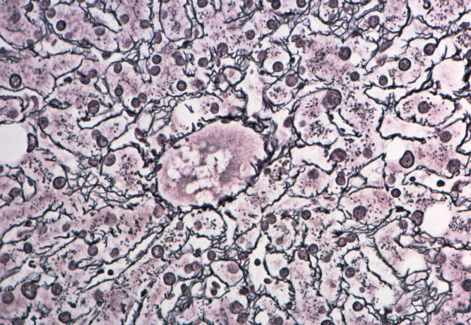 Cases: Gastrointestinal (Seminar 3: HISTOLOGY OF THE LIVER)